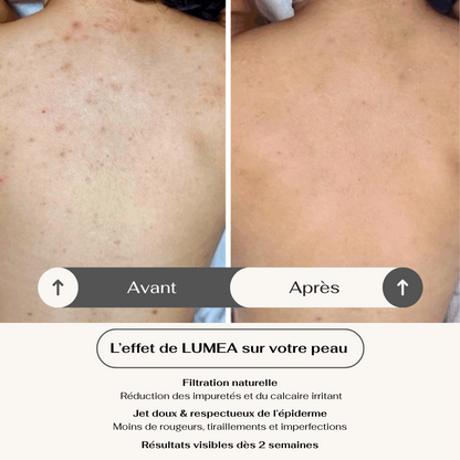 LUMEA